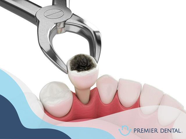 Bệnh răng miệng thường gặp