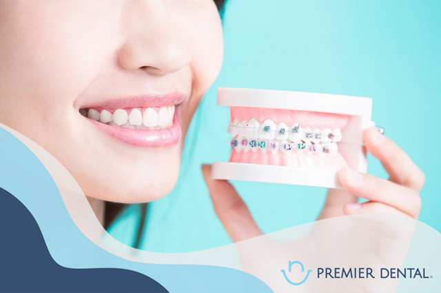 Niềng răng ở đâu tốt và đẹp