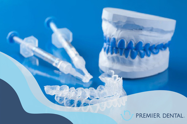 Máng tẩy trắng răng là gì