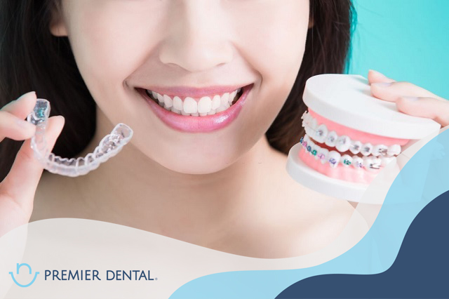 Niềng răng Invisalign có tốt không